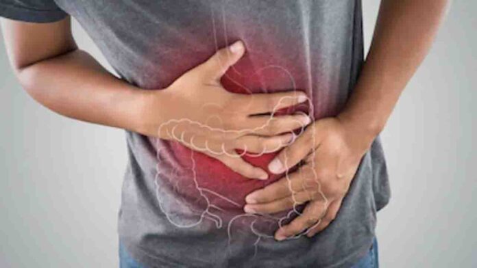 Ilustrasi penyakit usus(ekbisntb.com/ant)