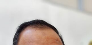 Turki Butuh Ribuan Tenaga Kerja NTB Turki Butuh Ribuan Tenaga Kerja NTB